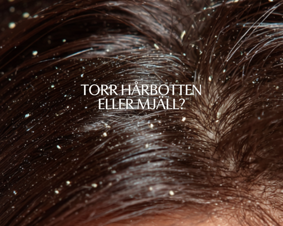 Närbild på mörkt hår med synliga mjällflagor i hårbotten. Bilden illustrerar skillnaden mellan torr hårbotten och mjäll.
